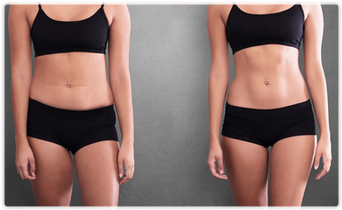 before-after-1-45b753060c181964fef0079fb311bfbd.png