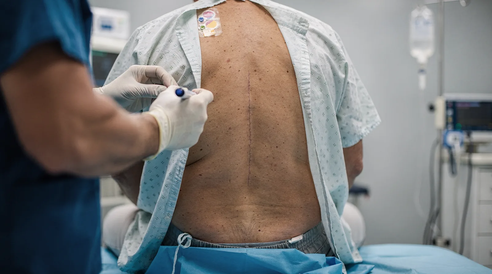 Spinal surgery carries risks including infection, bleeding, blood clots, and nerve irritation, even though serious
